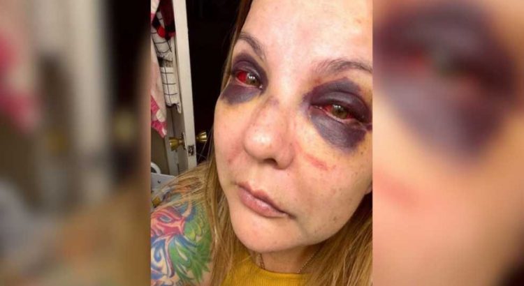 Oficiales de policía son acusados de golpear a una mujer después de un accidente.
