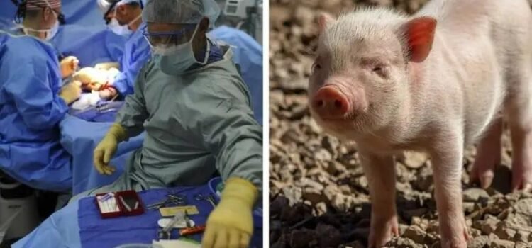 Realizan el primer trasplante de pulmón de cerdo a un humano en muerte cerebral