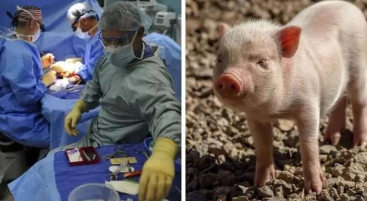 Realizan el primer trasplante de pulmón de cerdo a un humano en muerte cerebral